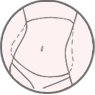 Plastická chirurgia